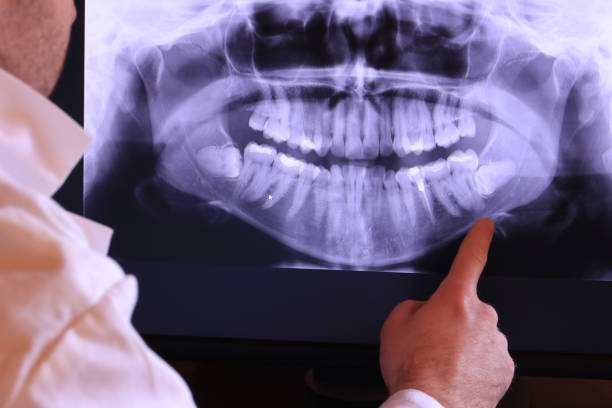 Best Root Canal Emergency Dentist  in Cresson, TX